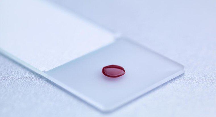 Co to jest badanie krwi LDH?