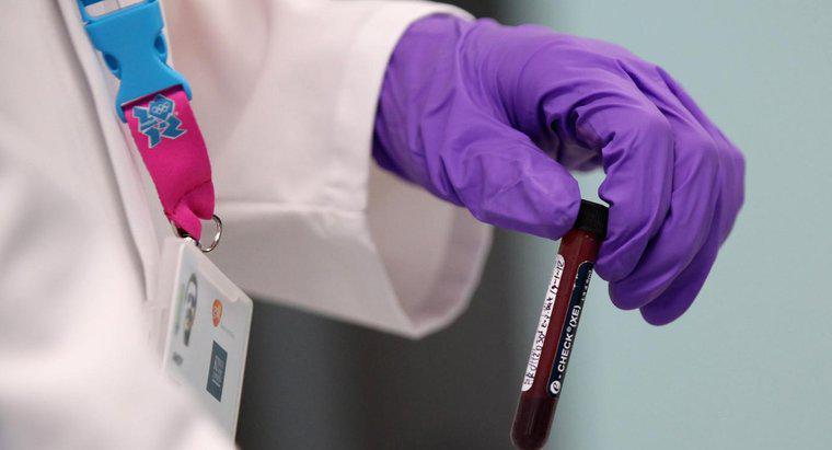 Czy Twoja grupa krwi może się zmienić?