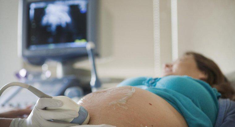 Kiedy Ultrasound pokaże płeć dziecka?