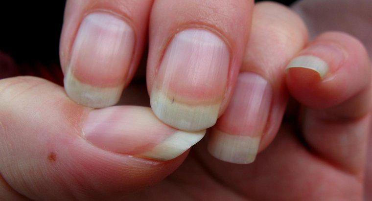 Co powoduje powstawanie bruzd w paznokciach?