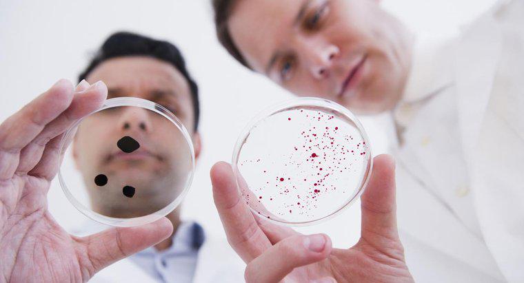 Jaka jest różnica między pierwotniakami a bakteriami?