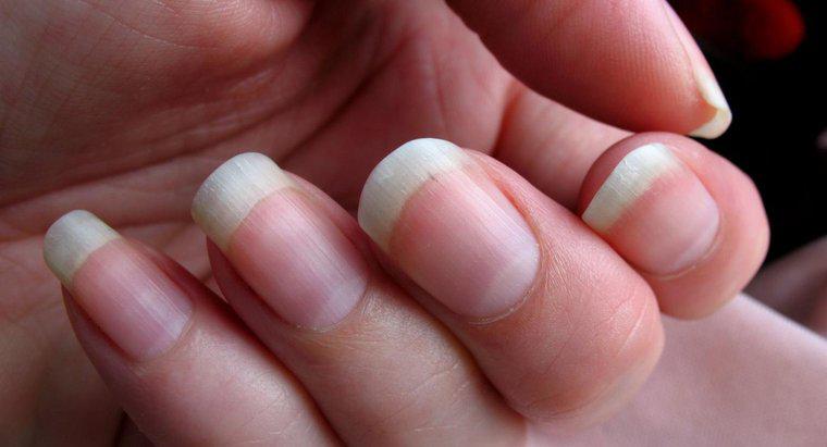 Jaki jest najlepszy sposób na usunięcie głębokiego odłamka pod paznokciem?