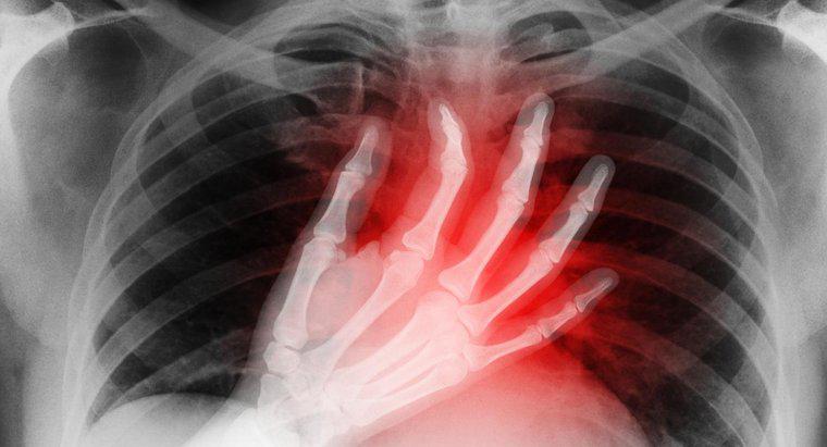 Jakie są objawy małego ataku serca?