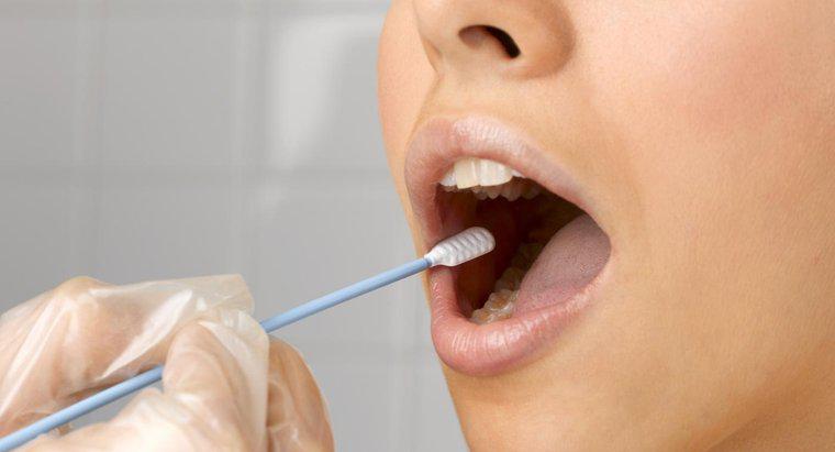 Jak dokładne są testy leków na wymaz z jamy ustnej?