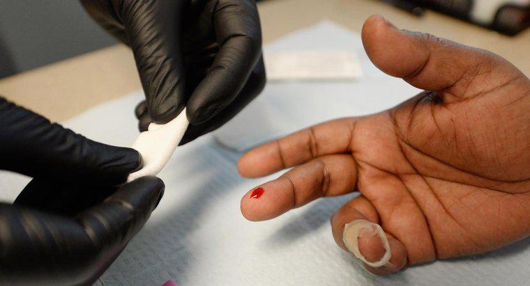 Ile czasu zajmuje zarażenie wirusem HIV w testach?