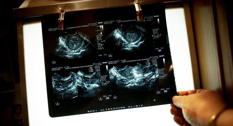 Jaka jest różnica między ultrasonografem a inwazją?