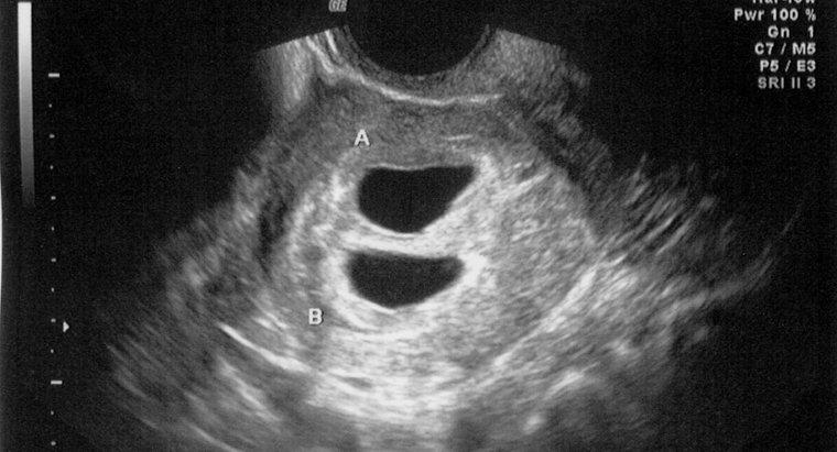 Czy USG może wykryć ciążę w 4 tygodnie?