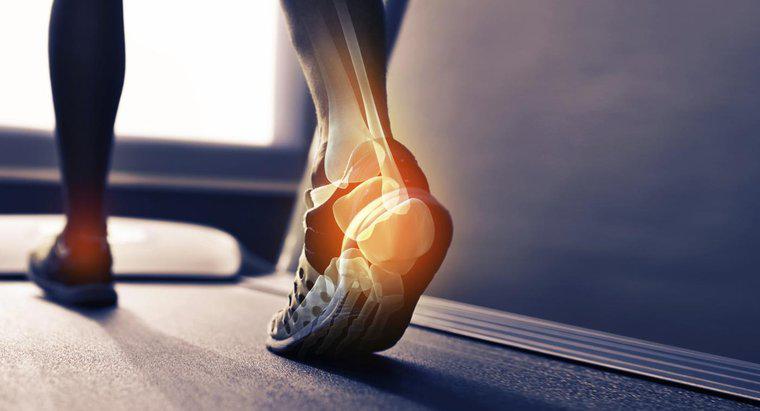 Co powoduje spazm kości na pięcie twojej stopy?