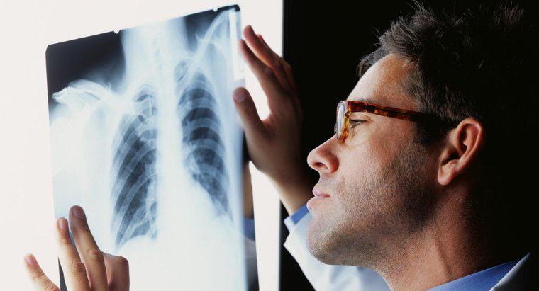 Jak leczy się infekcję płuc?