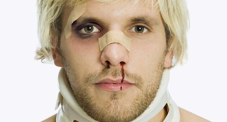Jak leczyć Bruised Nose?