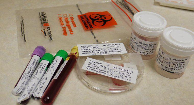 Jak długo można przechowywać próbki krwi w lodówce?