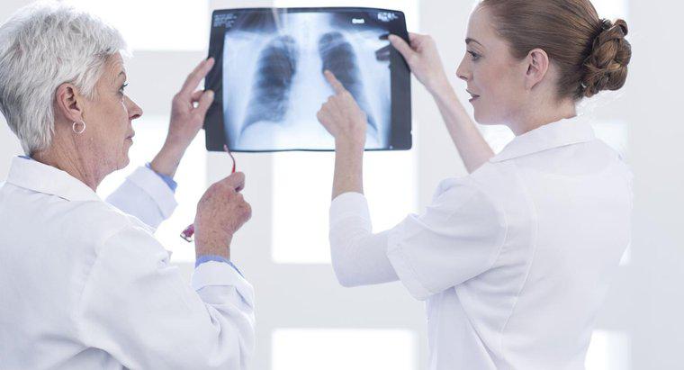 Co robią płuca w układzie oddechowym?