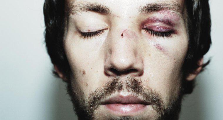 Jak uzyskać rany na twarzy, aby szybciej się wyleczyć?