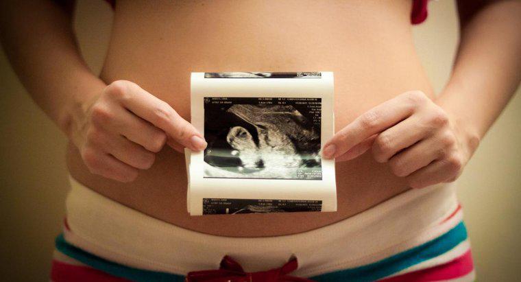 Jaki jest prawidłowy porządek etapów rozwoju prenatalnego?