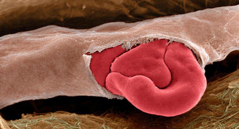 Co powoduje pękanie naczyń krwionośnych?