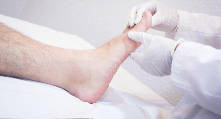 Jakie zagrożenia dla zdrowia występują w obrzękniętych stopach?