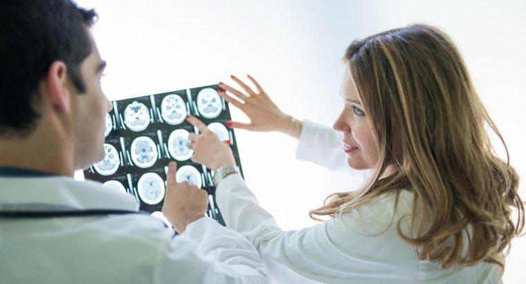 Jakie są objawy guza mózgu?