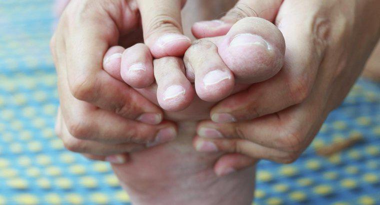 Jak złagodzić ból z odcisków między palcami?