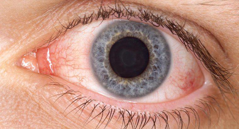 W jaki sposób kwas borny pomaga w różowym oku?