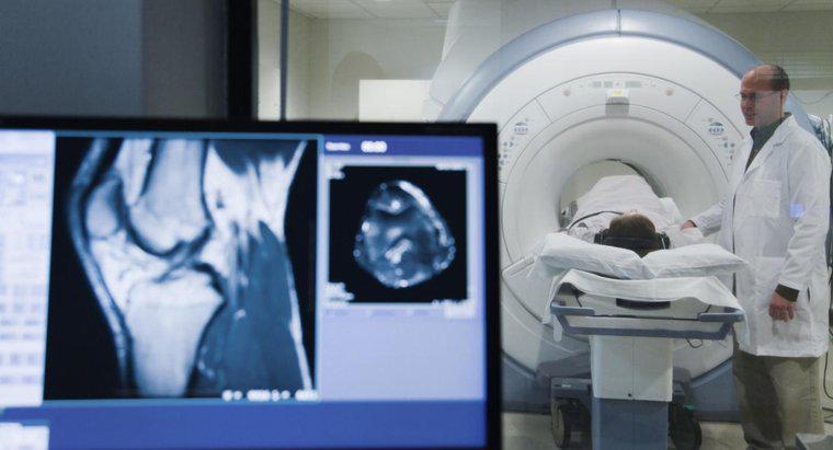 Jaki jest średni koszt MRI w kolanie?
