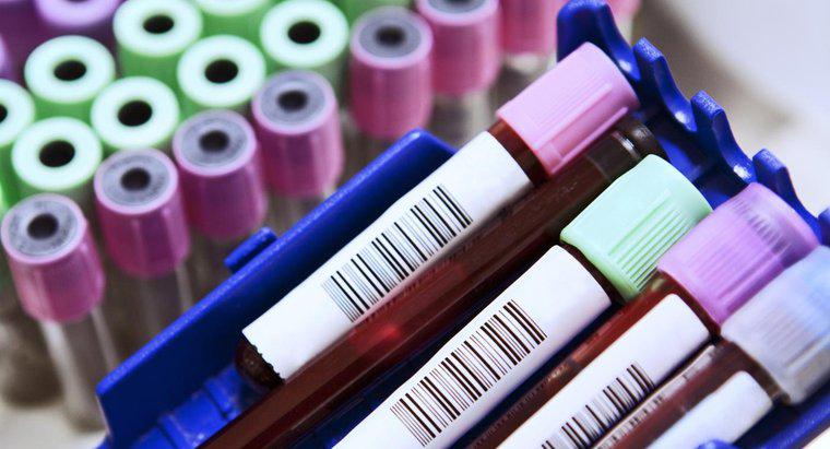 Jakie są wspólne skróty w badaniu krwi?