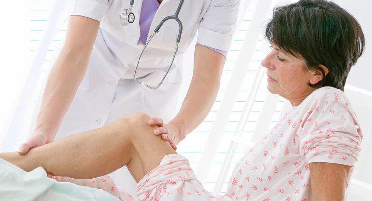 Co powoduje ból nerwu w nodze?