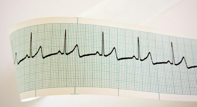 Co powoduje szybkie bicie serca?