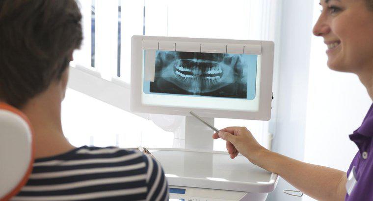 Jakie są plusy i minusy Mini implantów dentystycznych?
