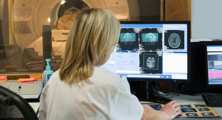 Co oznacza biała plamka na MRI mózgu?