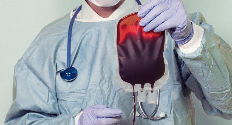 Czym jest pozbawiona tlenu krew?