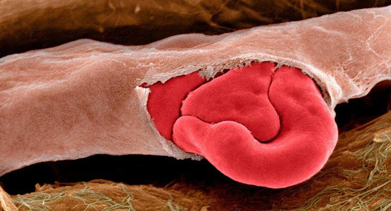 Co powoduje pękanie naczynek krwionośnych na nosie?