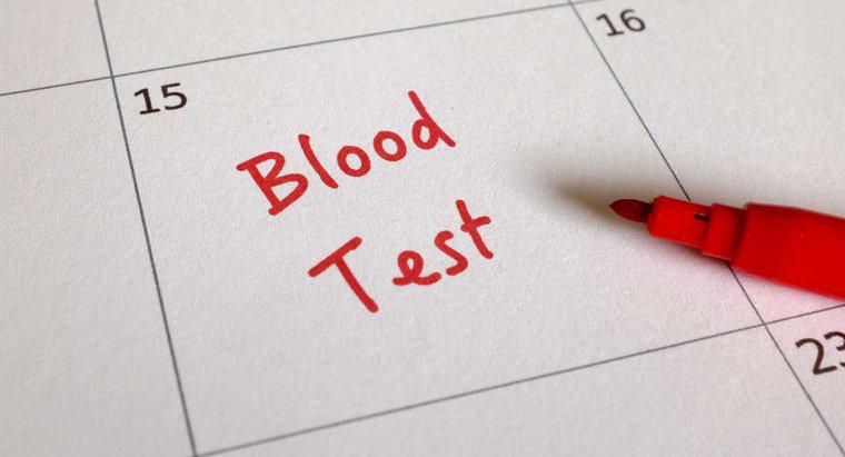 Co to jest test krwi CA 125?