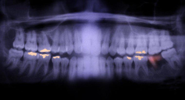 Czy zły ząb może powodować choroby?