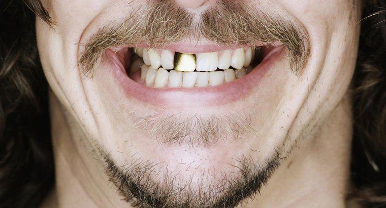 Jak Czyścisz Złote Zęby?