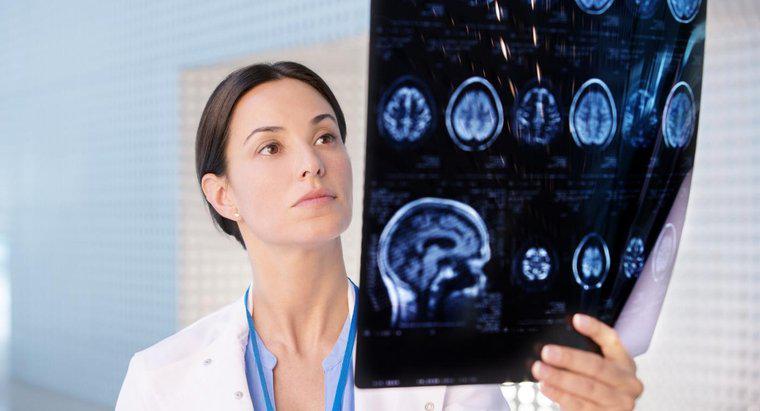 Czym jest lekarz, który bada mózg?