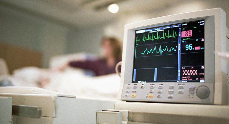 Jak czytać paski testowe EKG?