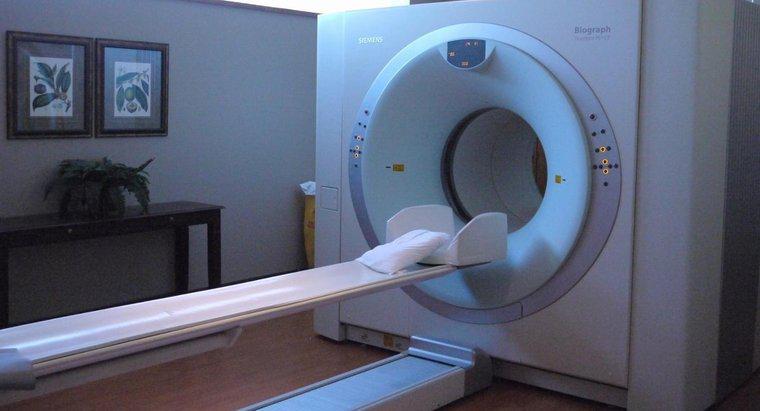 Co pokazuje CT Scan Scan?