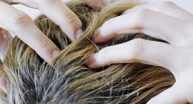 Co powoduje swędzenie skóry głowy i wypadanie włosów?