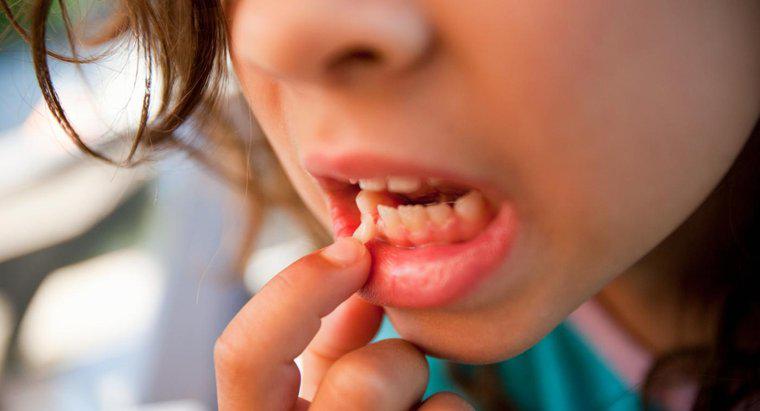 Co powoduje luźne zęby u dorosłych?