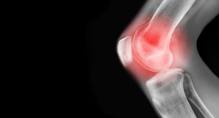 Jakie są przyczyny bólu w lewym kolanie?