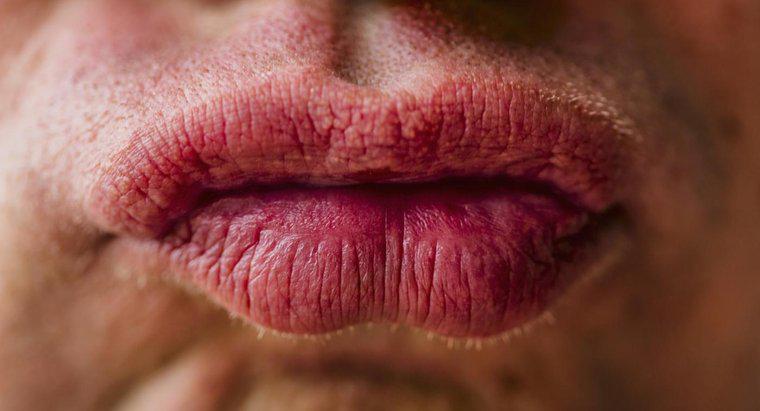 Jak leczyć usta, które są spuchnięte z powodu alergii?