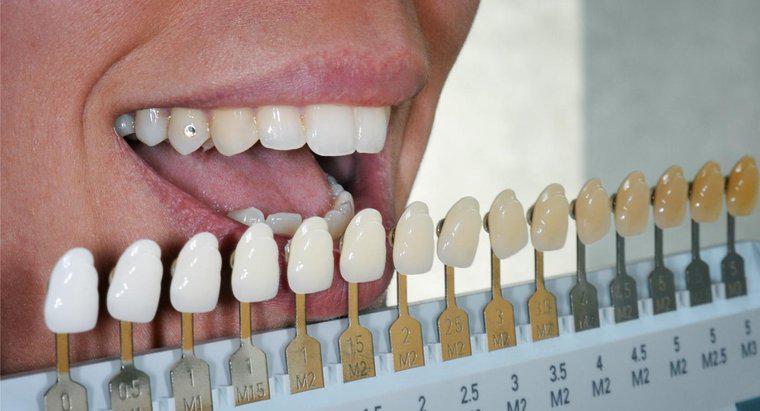 Czy Fake Teeth Be Whitened?