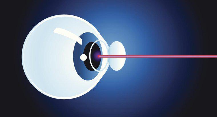Co to jest laserowa operacja zaćmy?