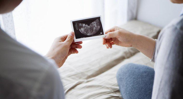 Jak ustalić, czy płód jest mężczyzną czy kobietą?