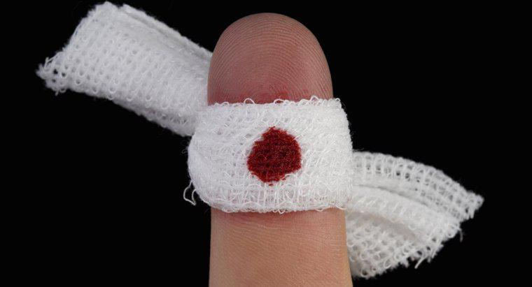 Dlaczego mój palec nie przestanie krwawić?