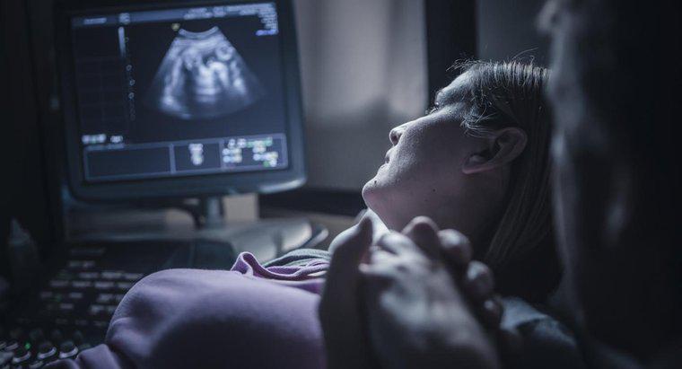 Jak daleko musisz być, aby usłyszeć bicie serca dziecka podczas ultrasonografii?