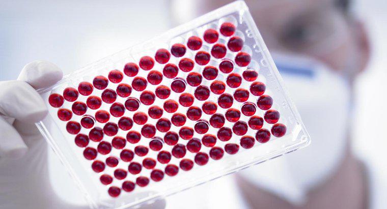 Co oznacza niski MPV w badaniu krwi?