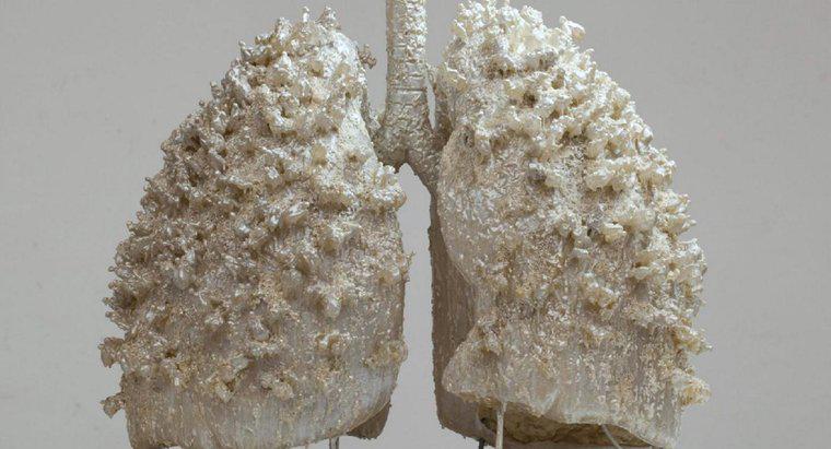 Czy osoba może żyć z jednym płucem?