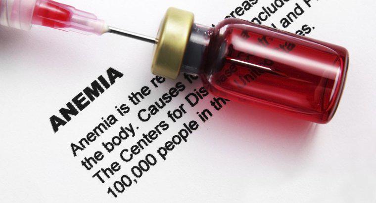 W jaki sposób można sprawdzić poziomy krwi w anemii?