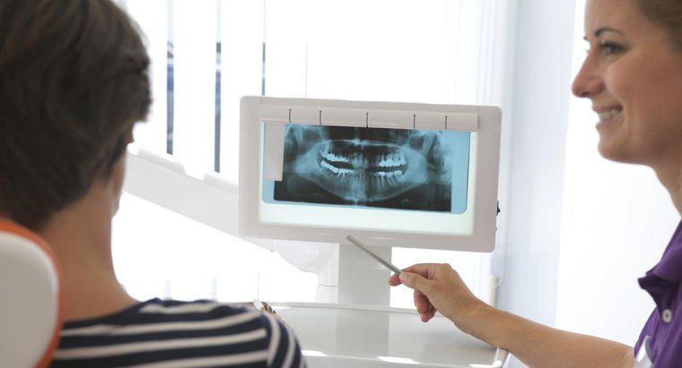 Ile powinienem płacić za implanty dentystyczne?